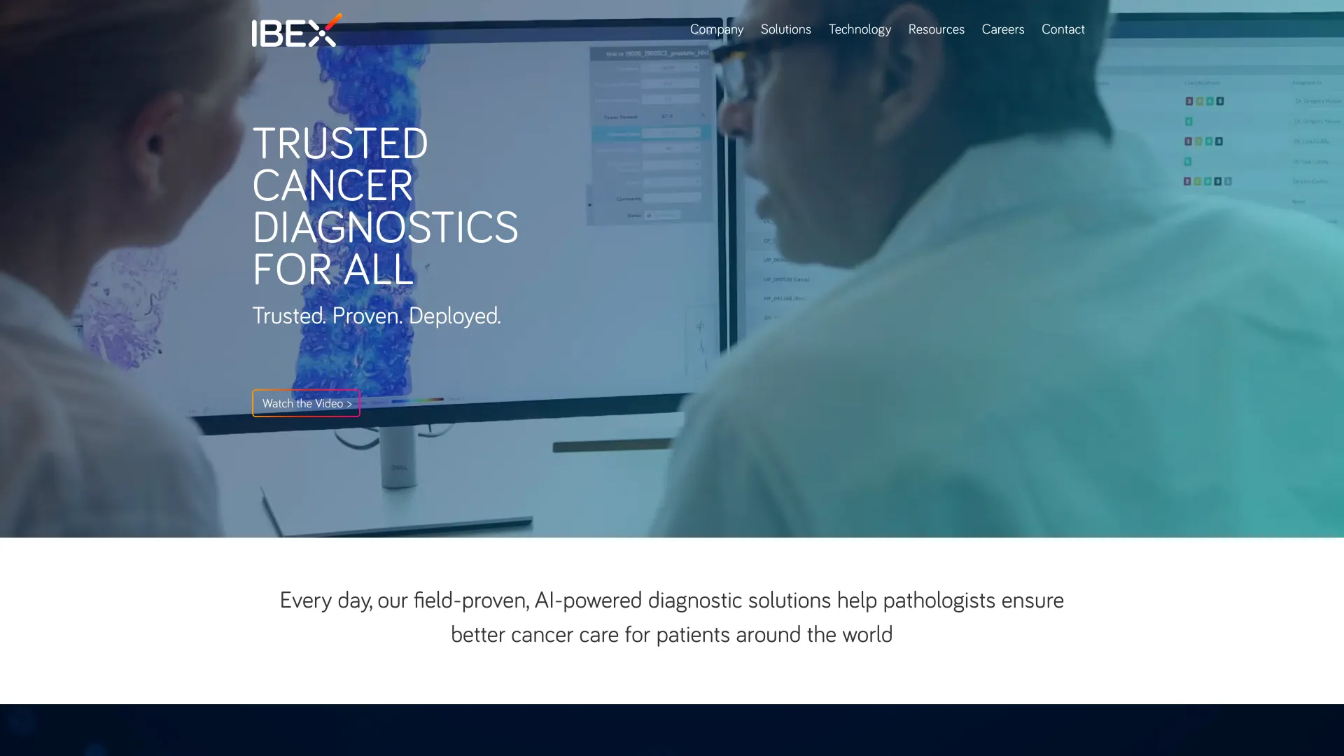 Ibex screenshot